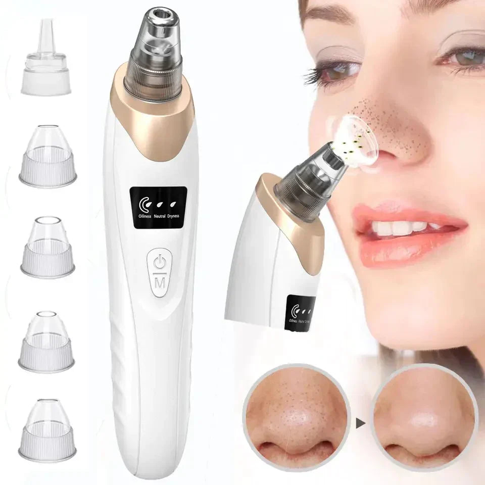 Get Clear Skin! Our Electric 5 in 1 Blackheads Removing Machine