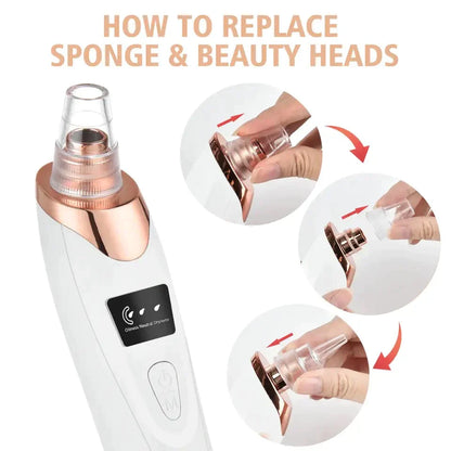 Get Clear Skin! Our Electric 5 in 1 Blackheads Removing Machine